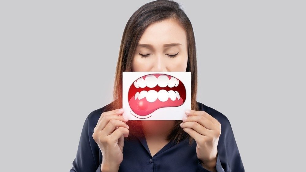 Periodontal Disease Treatment